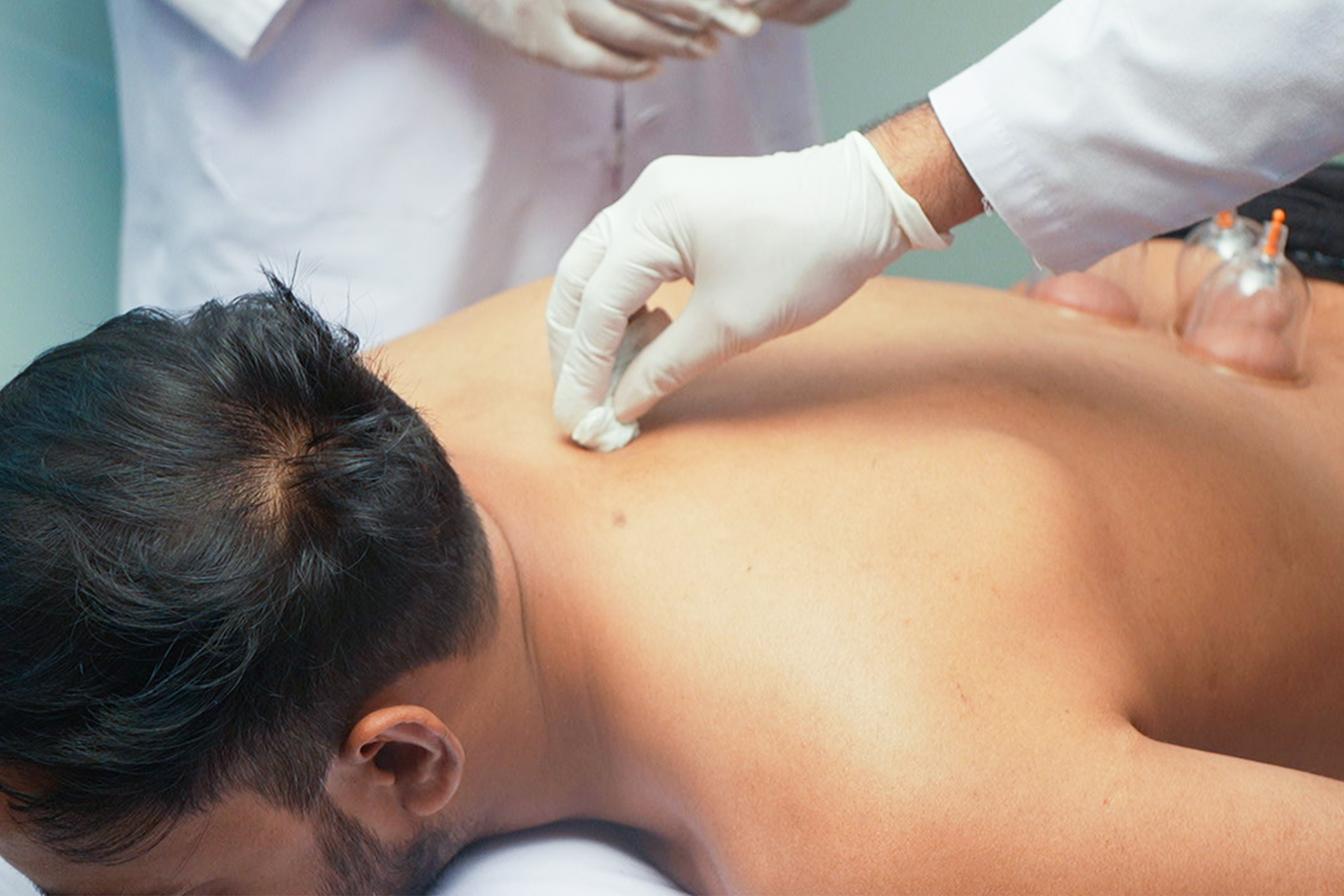 Hijama (Cupping Therapy)